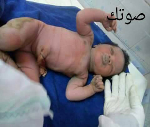 العثور على طفلة رميت بعد ولادتها قرب مستشفى زايد بنواكشوط ( فيديو )