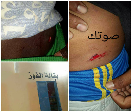 الرياض : طعن عاملين في بقالة الفوز والإستيلاء على أموال