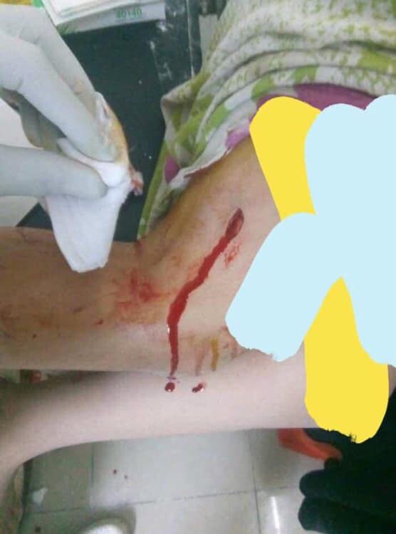 دار النعيم : شيخ محظرة يطعن طالبته بسكين في الفخذ